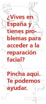 ¿Se puede tratar la lipodistrofia en la cara? ¿Lo cubre la Seguridad Social?