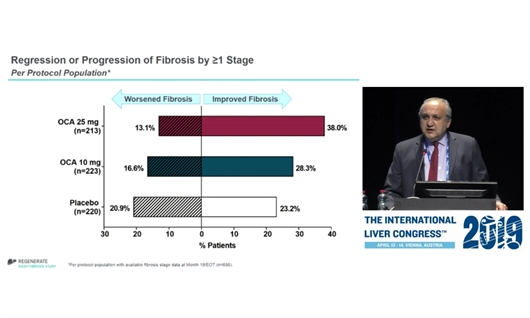 Diapositiva del estudio presentado por Zobair Younossi en el Congreso Internacional del Hígado. Imagen de la retransmisión en directo de EASL.