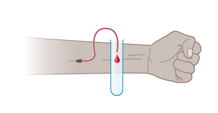 Imagen: Prueba con sangre del brazo