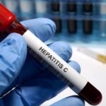 Test Hepatitis C