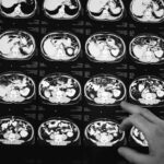 Escáner del cerebro. Foto: Freepik