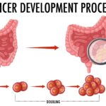 Cáncer. Imagen: Freepik