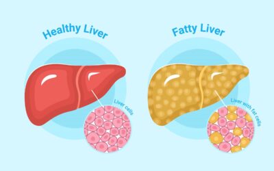 Semaglutida mejora diversos indicadores de salud cardiovascular en personas con el VIH e hígado graso