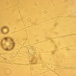 Trichophyton mentagrophytes. Infección fúngica. O Cerna | Flickr