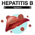 Hepatitis B. VHB. Imagen: Freepik