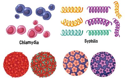 Las ITS aumentan en España: un desafío de salud pública que exige más equidad y derechos