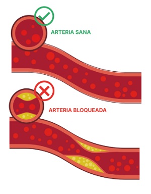 InfoVIHtal_2025_estatinas