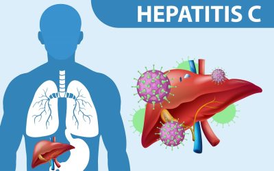 La hepatitis C aguda sigue siendo un desafío entre personas con el VIH y usuarias de PrEP que practican chemsex
